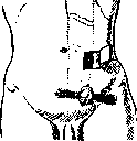 Anus: figure 2 from the 1928–1936 encyclopedia article