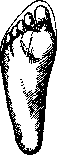 Hallux Valgus: figure 3 from the 1928–1936 encyclopedia article