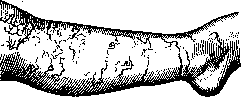 Larva (Ml GRANS, "bluzhdayushchaya lichinka",): figure 2 from the 1928–1936 encyclopedia article