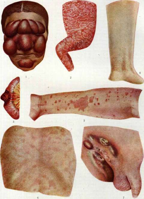 Lichen: figure 1 from the 1928–1936 encyclopedia article