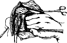 Pulmonary Artery: figure 12 from the 1928–1936 encyclopedia article