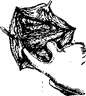 Pulmonary Artery: figure 8 from the 1928–1936 encyclopedia article