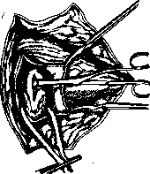 Pulmonary Artery: figure 10 from the 1928–1936 encyclopedia article