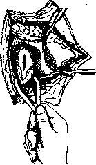 Pulmonary Artery: figure 9 from the 1928–1936 encyclopedia article