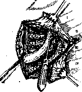 Pulmonary Artery: figure 7 from the 1928–1936 encyclopedia article
