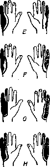 Ulnar Nerve: figure 4 from the 1928–1936 encyclopedia article