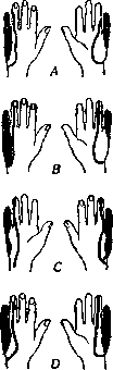 Ulnar Nerve: figure 3 from the 1928–1936 encyclopedia article