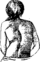 Scoliosis: figure 3 from the 1928–1936 encyclopedia article