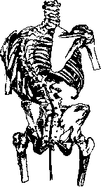 Scoliosis: figure 4 from the 1928–1936 encyclopedia article