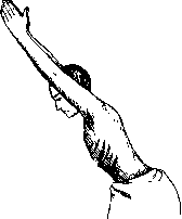 Scoliosis: figure 5 from the 1928–1936 encyclopedia article