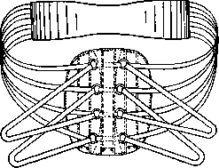 VERBOV BANDAGE: figure 1 from the 1928–1936 encyclopedia article