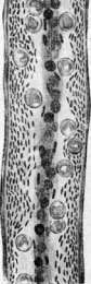 Thrombus: figure 4 from the 1928–1936 encyclopedia article