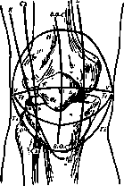 Arthrotomy: figure 4 from the 1928–1936 encyclopedia article