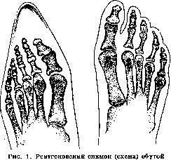 Footwear: figure 1 from the 1928–1936 encyclopedia article
