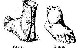 Footwear: figure 5 from the 1928–1936 encyclopedia article