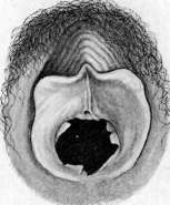 Hymen: figure 2 from the 1928–1936 encyclopedia article