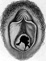 Hymen: figure 4 from the 1928–1936 encyclopedia article