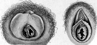 Hymen: figure 6 from the 1928–1936 encyclopedia article