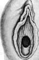 Hymen: figure 5 from the 1928–1936 encyclopedia article