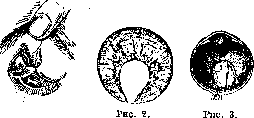 Coloboma: figure 1 from the 1928–1936 encyclopedia article