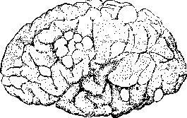 Tuberous Sclerosis: figure 1 from the 1928–1936 encyclopedia article