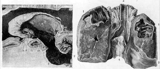 Capsula Externa: figure 2 from the 1928–1936 encyclopedia article