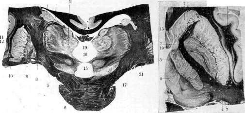 Capsula Externa: figure 1 from the 1928–1936 encyclopedia article