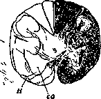 Helweg's Fasciculus: figure 1 from the 1928–1936 encyclopedia article