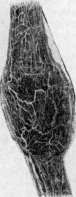 Crystals: figure 4 from the 1928–1936 encyclopedia article