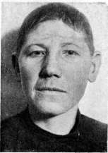 Eunuchoidism: figure 1 from the 1928–1936 encyclopedia article
