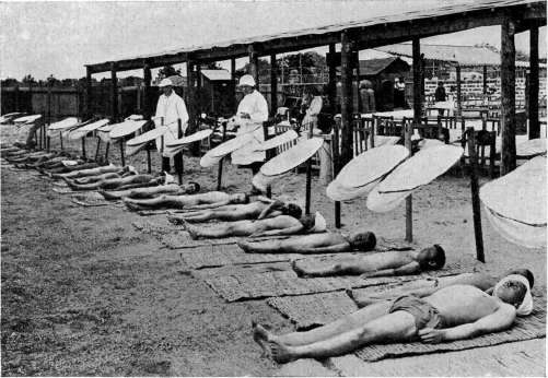 Eunuchoidism: figure 5 from the 1928–1936 encyclopedia article