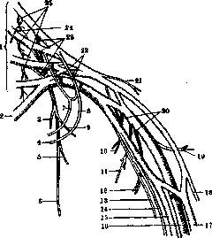 Duchenne-Erb Paralysis: figure 1 from the 1928–1936 encyclopedia article