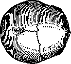 Brachycephaly: figure 1 from the 1928–1936 encyclopedia article