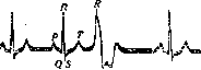 Electrocardiography: figure 14 from the 1928–1936 encyclopedia article