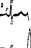Electrocardiography: figure 17 from the 1928–1936 encyclopedia article