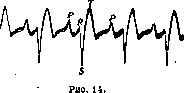Electrocardiography: figure 12 from the 1928–1936 encyclopedia article