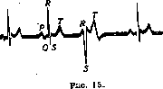 Electrocardiography: figure 13 from the 1928–1936 encyclopedia article