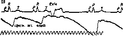 Electrocardiography: figure 16 from the 1928–1936 encyclopedia article