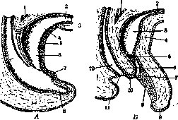 Urachoplasty: figure 2 from the 1928–1936 encyclopedia article