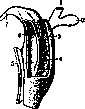 Urachoplasty: figure 1 from the 1928–1936 encyclopedia article