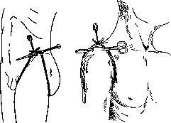 Blood Vessels (525): figure 18 from the 1928–1936 encyclopedia article