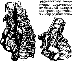 Blood Vessels (525): figure 6 from the 1928–1936 encyclopedia article