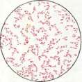 Diphtheritis: figure 10 from the 1928–1936 encyclopedia article
