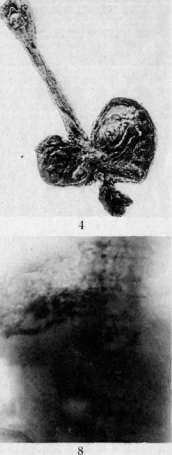 Esophagus: figure 7 from the 1928–1936 encyclopedia article