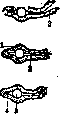 Esophagus: figure 13 from the 1928–1936 encyclopedia article