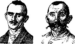 Pseudodementia: figure 1 from the 1928–1936 encyclopedia article