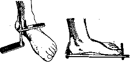 Flatfoot: figure 5 from the 1928–1936 encyclopedia article