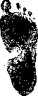 Flatfoot: figure 4 from the 1928–1936 encyclopedia article