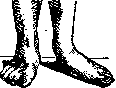 Flatfoot: figure 8 from the 1928–1936 encyclopedia article