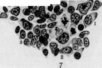 Hematopoiesis: figure 5 from the 1928–1936 encyclopedia article